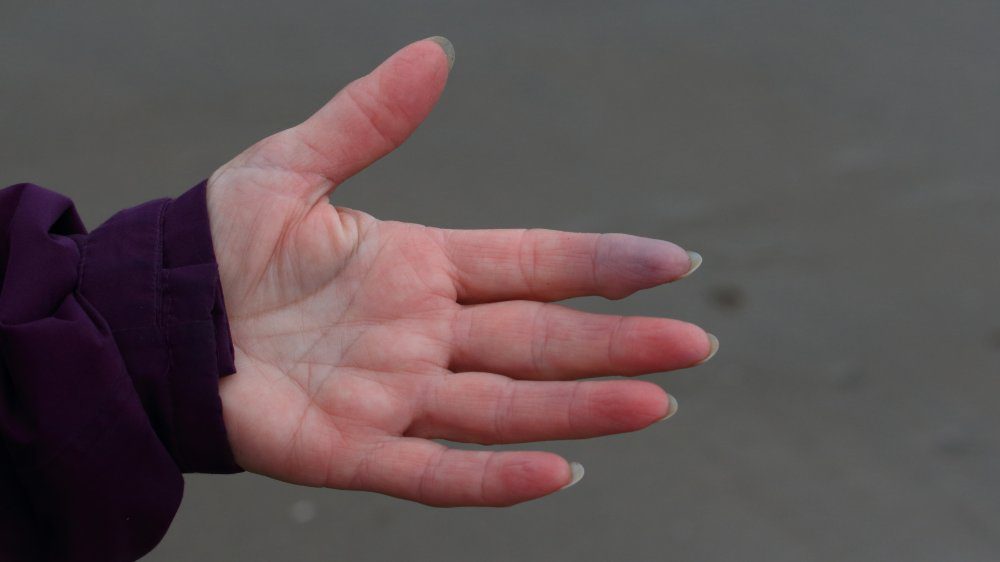 женщина с синими кончиками пальцев и ногтями