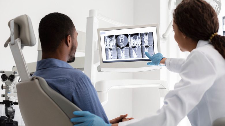 Мужчина рассматривает рентгеновские снимки зубов со своим стоматологом