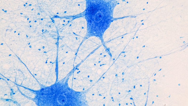 Нейроны под микроскопом