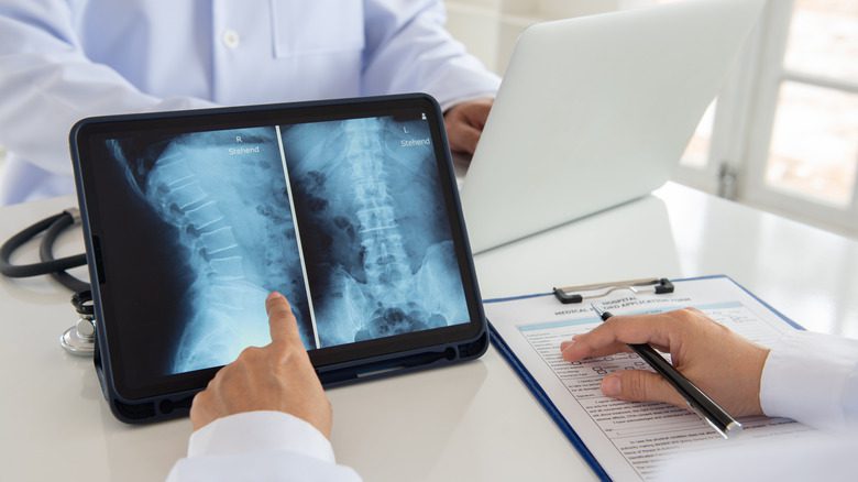 врач смотрит на рентгеновский снимок костей