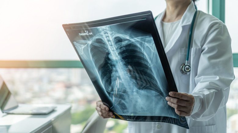 врач смотрит на рентгеновский снимок легких